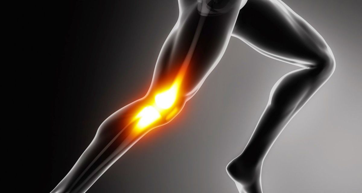 Síndrome de la cintilla iliotibial