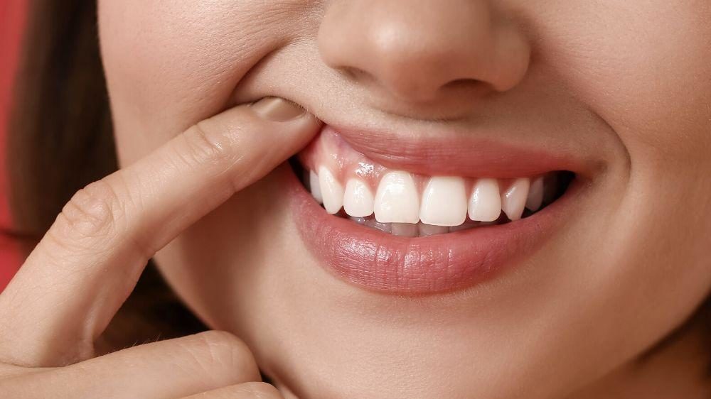 SALUD DENTAL Y RENDIMIENTO
