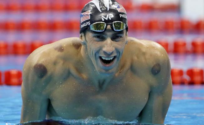 CUPPING O TRATAMIENTO CON VENTOSAS